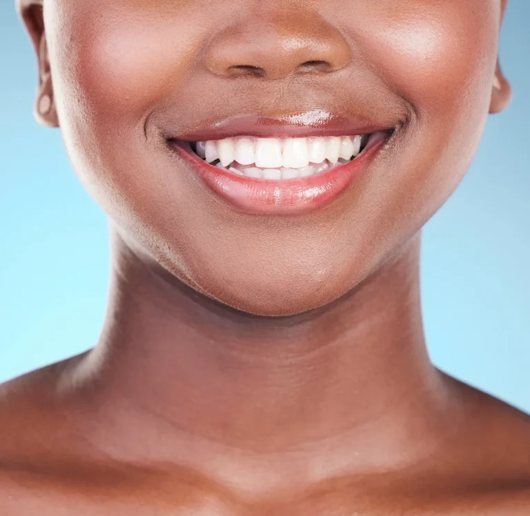 Patient smiling after professional teeth whitening in Richardson, TX