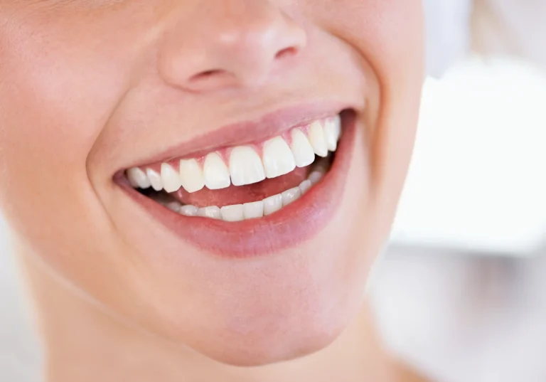 Close-up of a whiter smile after in-office whitening